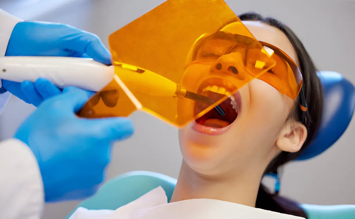 6 Little‑Known Benefits Of Professional Dental Sealants