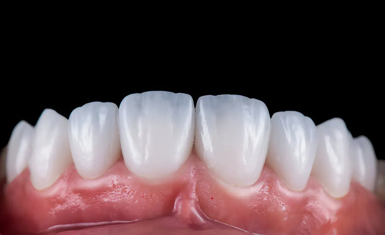 Understanding The Science Behind Porcelain Veneers